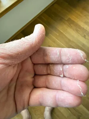 Hand.webp